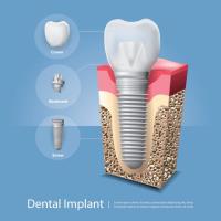 Lifetime Dental Care image 12